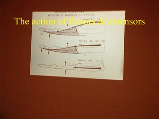 Extensography Principles Examination Of The Hand & Wrist | PPT