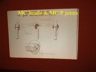 Mpcjs Hand Examination Of The Hand & Wrist | PPT