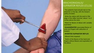 Inverted Reflex Examination of the motor system | PPTX