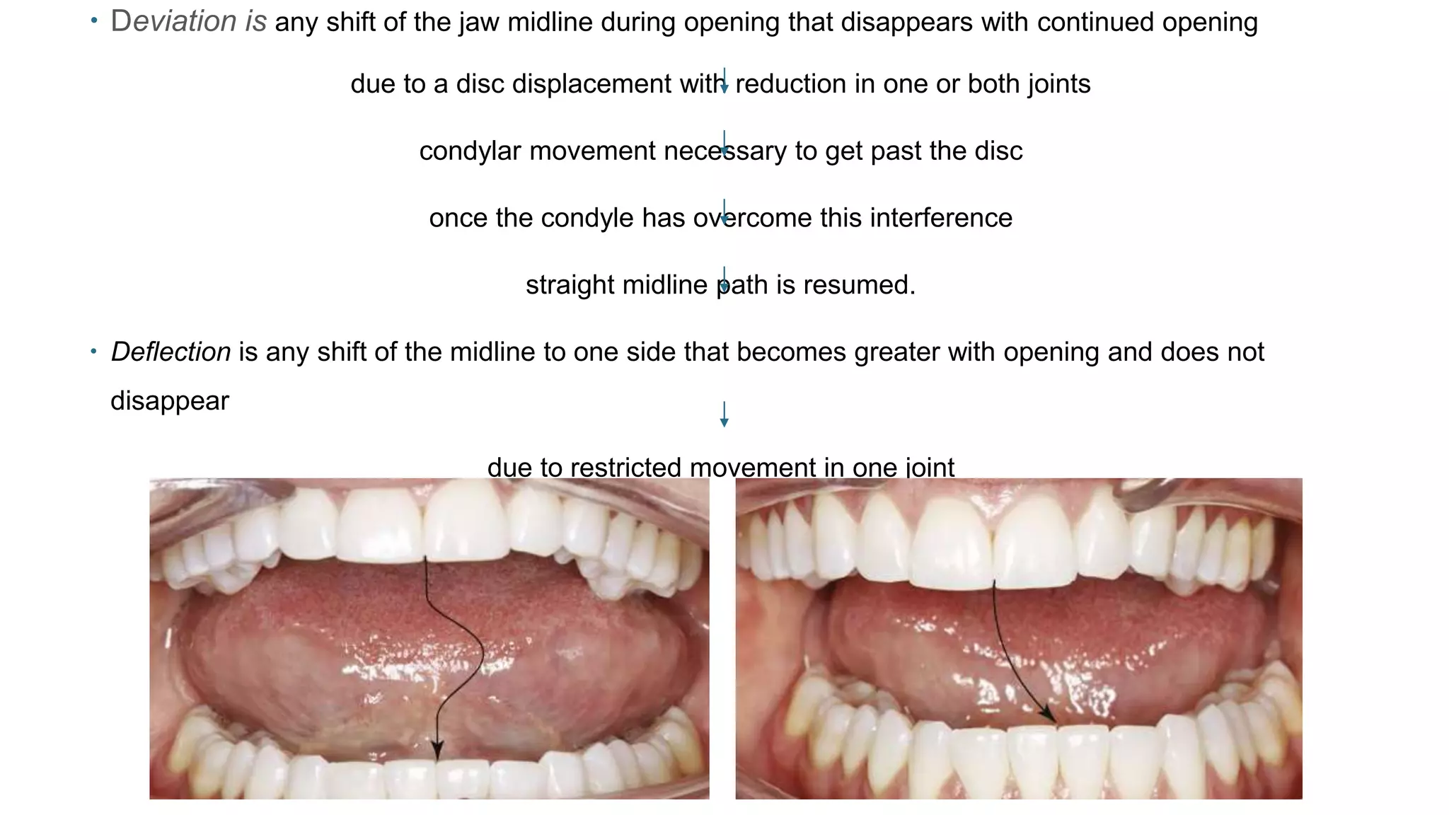 Examination and diagnosis of tmd | PPTX