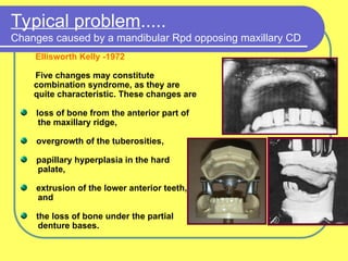 Lower Mn Rpd Examination_And_Evaluation_Of_Diagnostics ppt | PPT