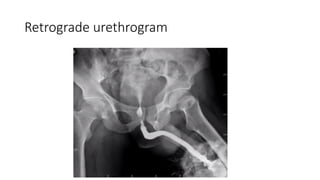 Examination And Investigation Of The Urogenital System for GUU.pptx