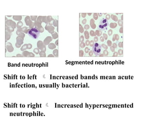 Left Shift Rbc Haematology Examination Blood Smear.pptx