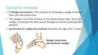 Parsectomy EXAMINATION,DIAGNOSIS & TREATMENT (2).pptx