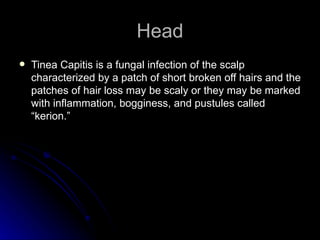 Head
   Tinea Capitis is a fungal infection of the scalp
    characterized by a patch of short broken off hairs and the
    patches of hair loss may be scaly or they may be marked
    with inflammation, bogginess, and pustules called
    “kerion.”
 