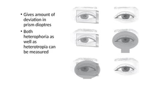 Examination in strabissmus (1).pptxdsfedf | PPTX