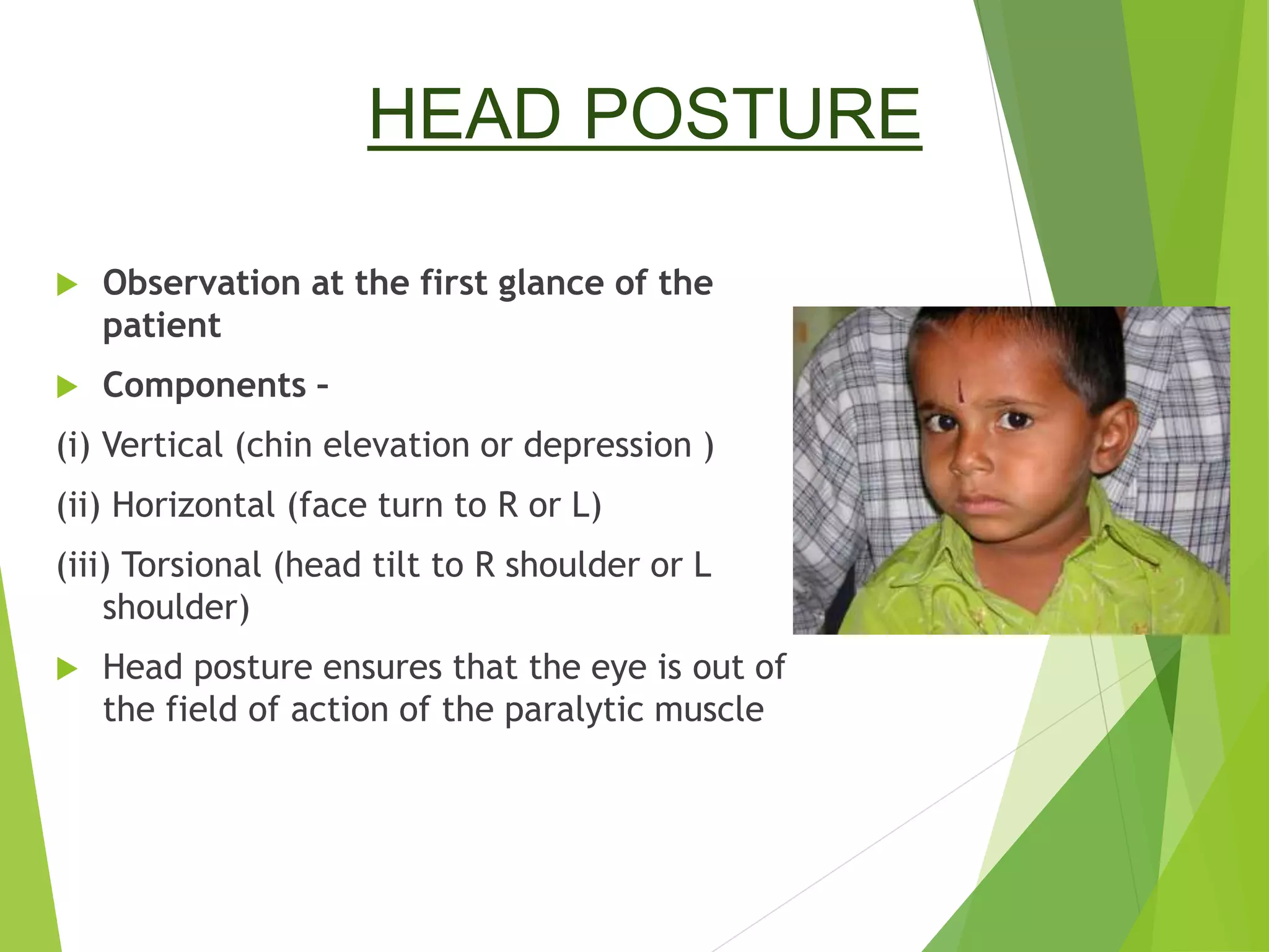 Examination of a case of squint | PPT