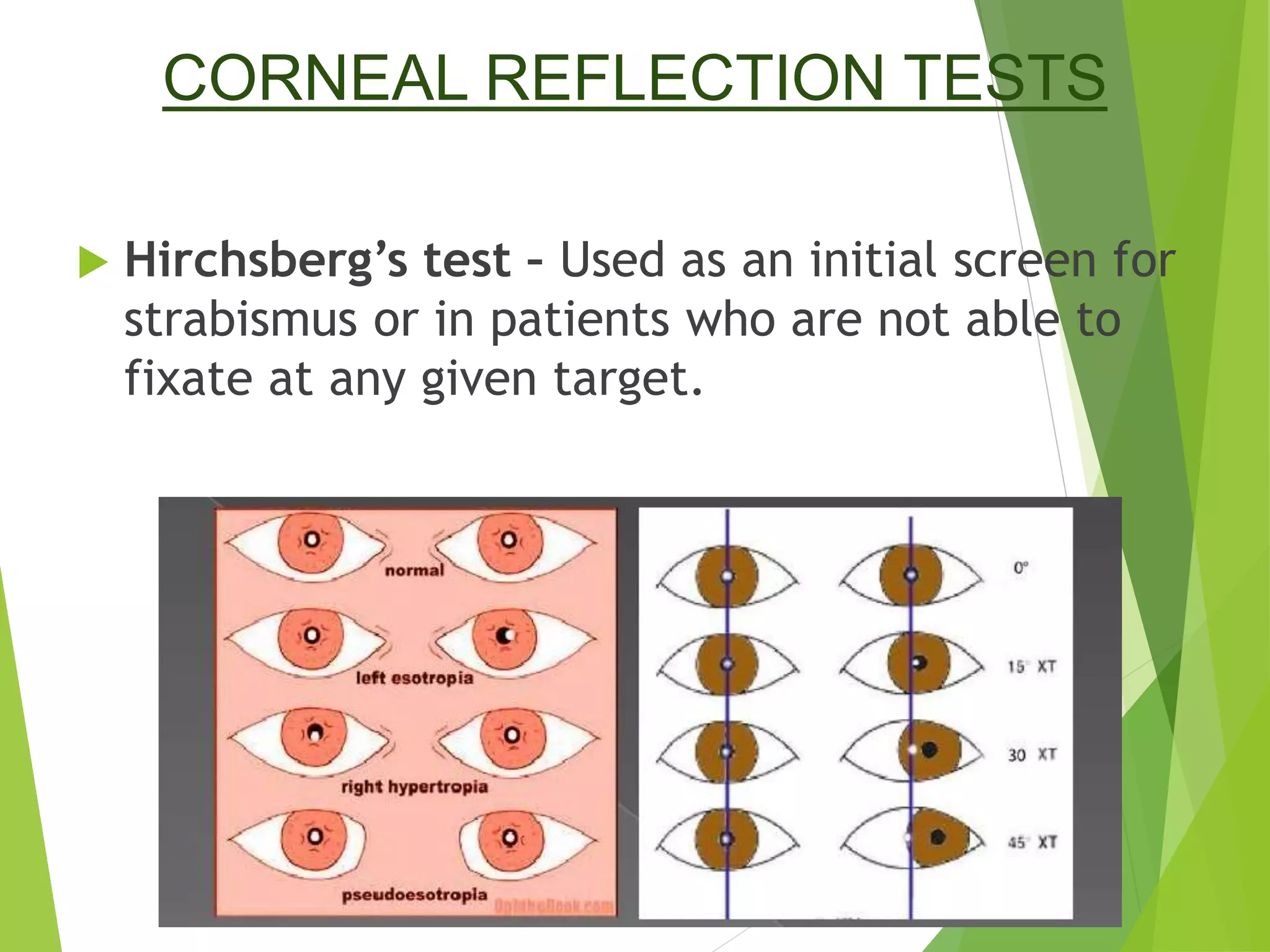 Hberg Test Examination of a case of squint | PPTX