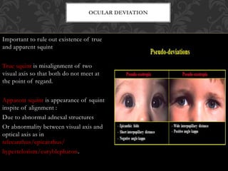 Visual Squint Examination of a case of strabismus | PPTX