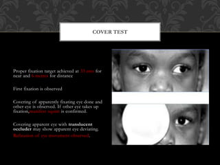 Examination of a case of strabismus | PPTX