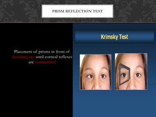 Examination of a case of strabismus | PPTX