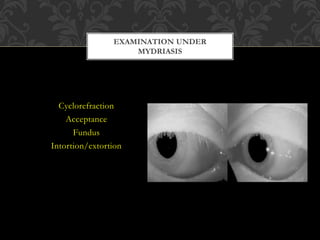Intortion Examination of a case of strabismus | PPTX