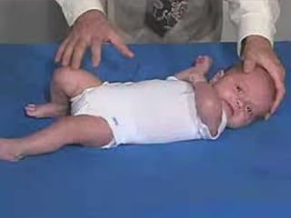 Neurological Examination of an infant | PDF