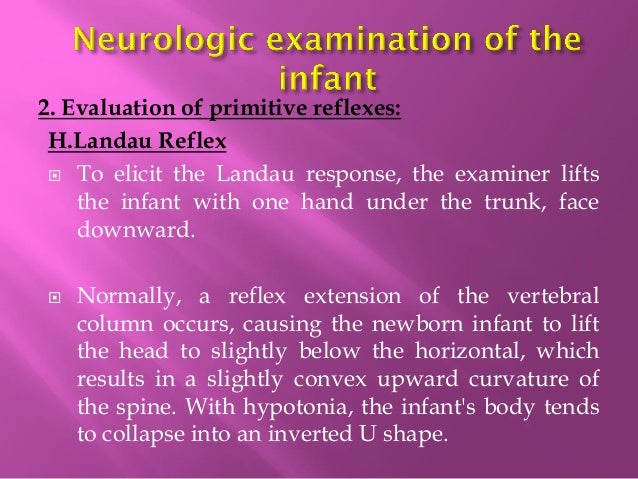 Neurological Examination of an infant