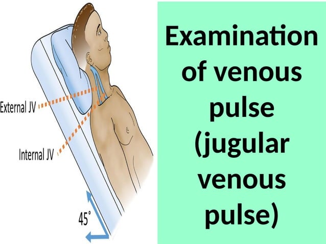 Examination of arterial and venous pulse copy.pptx