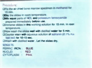 Procedure
OFx the air dried bone marrow specimen in methanol for
15 min.
aDythe slides in room temperature.
Mk equai parts of HCL and potassium ferrocyanide
prepared immediatelybetore use.
Oimmerse slides in this working solution for 15 min. in roon
temperature.
ONow wash the slides well with distilled water for 5 min.
OCounter stain with aqueous solution of safranin (0.1% nu
fast red) for 10-15 sec.
OWash with distiled water. Let the sides dry.
RESULTS
FERRIC 1AONBLUE
NUCLEI
CYTOPLASM
RED
PINK
 