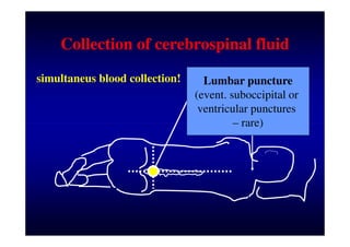 Examination of cerebrospinal fluid - Kalousová M.(english).pdf