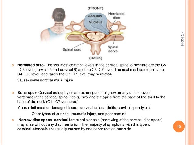 Examination of cervical disorder