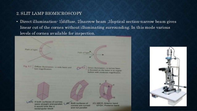 Examination of cornea welding defects with diagram 