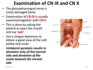 Examination of Cranial Nerves.pptx Anatomy | PPTX