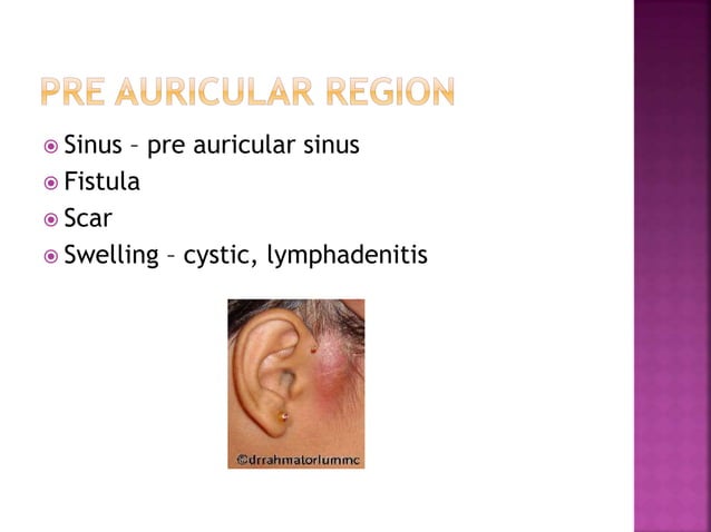 Examination of ear | PPTX