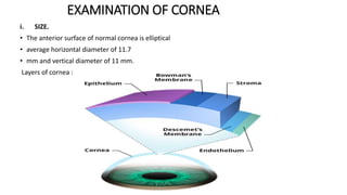 Examination of eye | PPTX