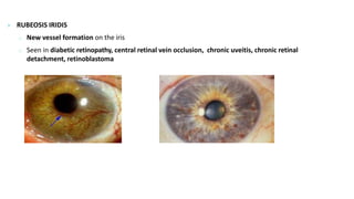Examination of eye | PPTX