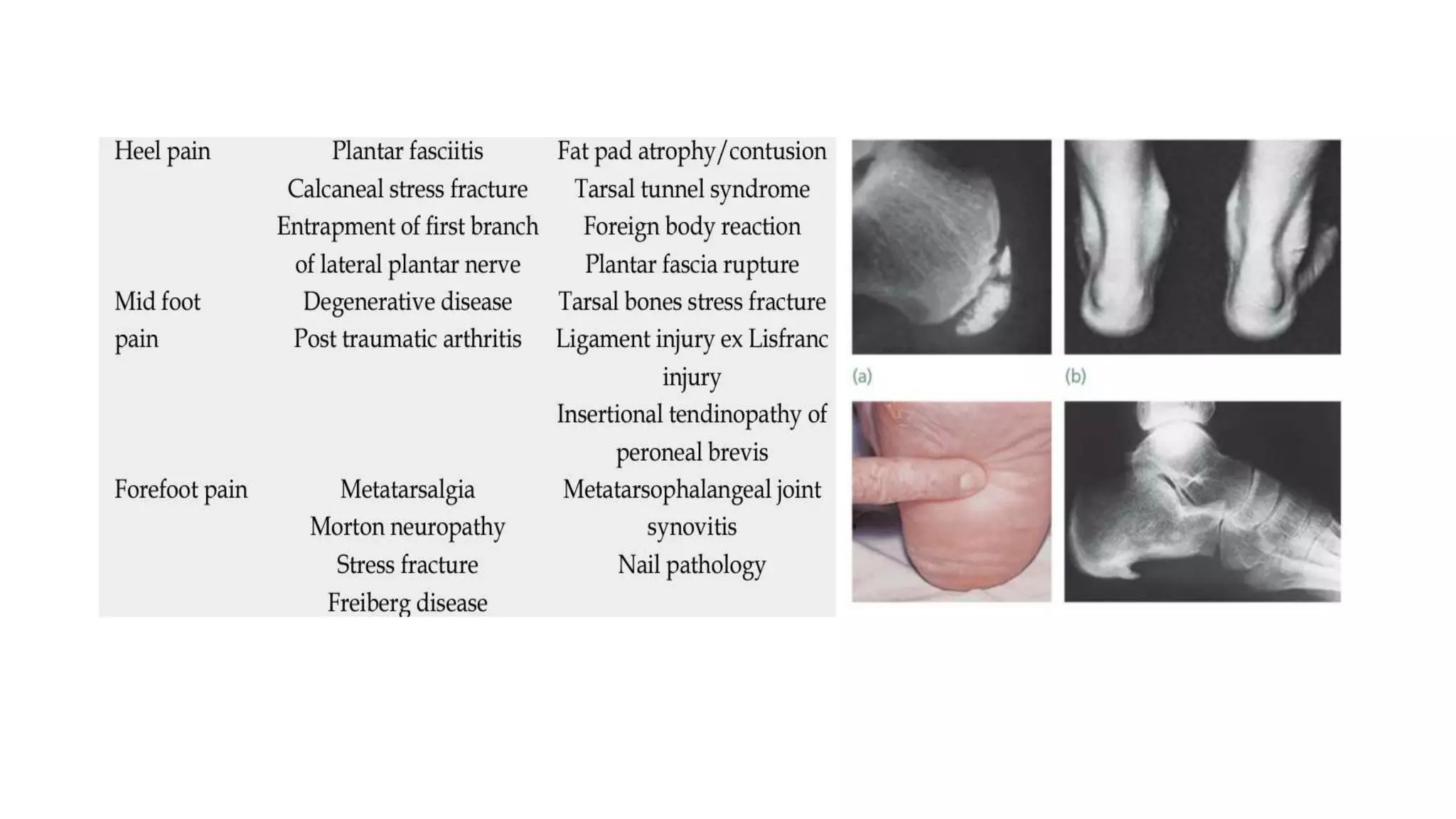 Jfar Examination of foot and ankle slideshare | PPTX