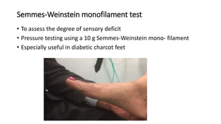 Examination of foot and ankle slideshare | PPTX