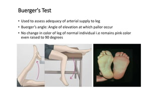 Buerger Color Examination of foot and ankle slideshare | PPTX
