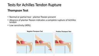 Examination of foot and ankle slideshare | PPTX