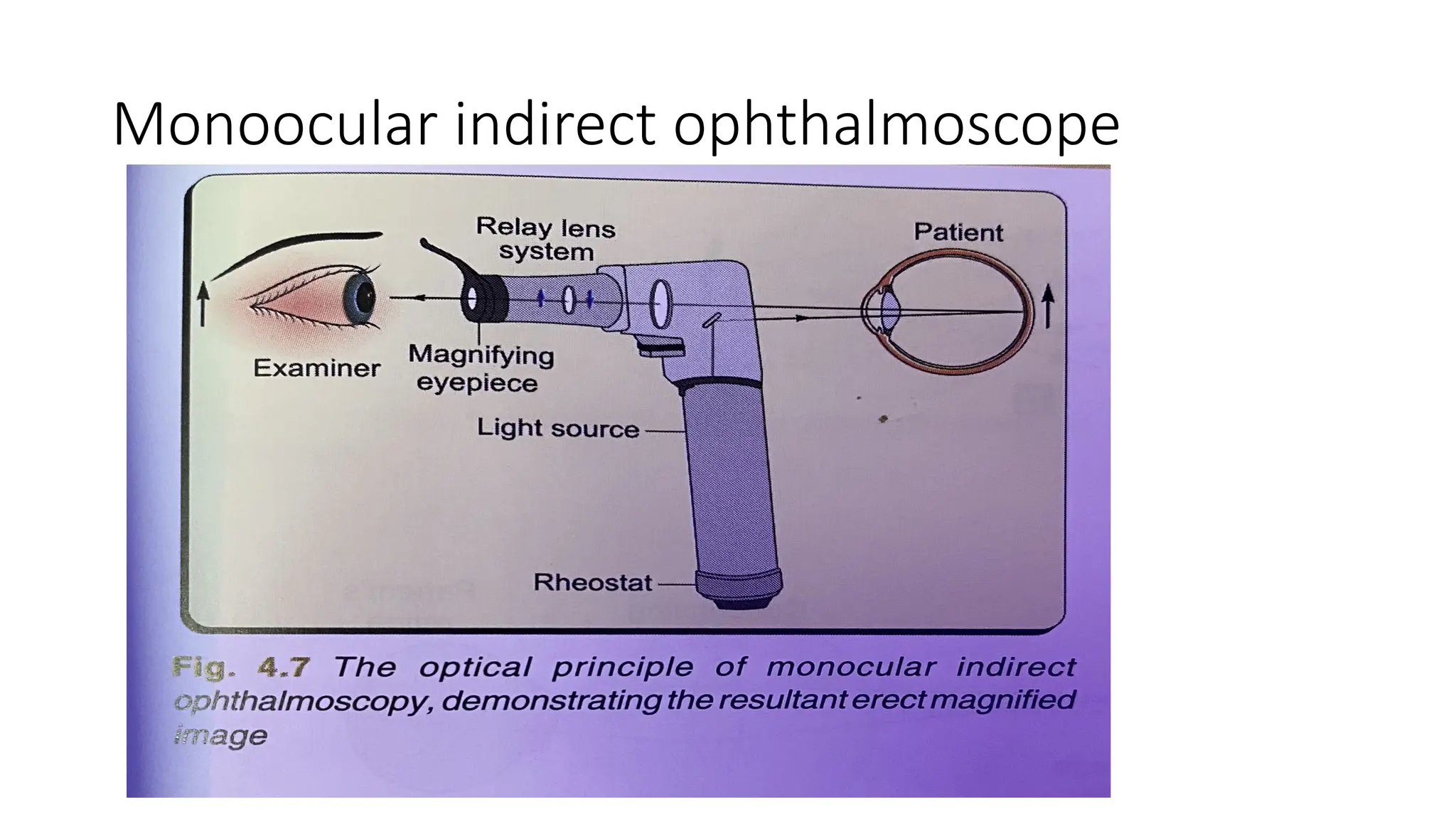 Monoocular indirect ophthalmoscope
 