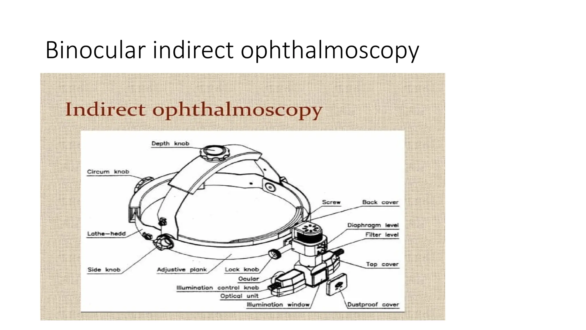 Binocular indirect ophthalmoscopy
 