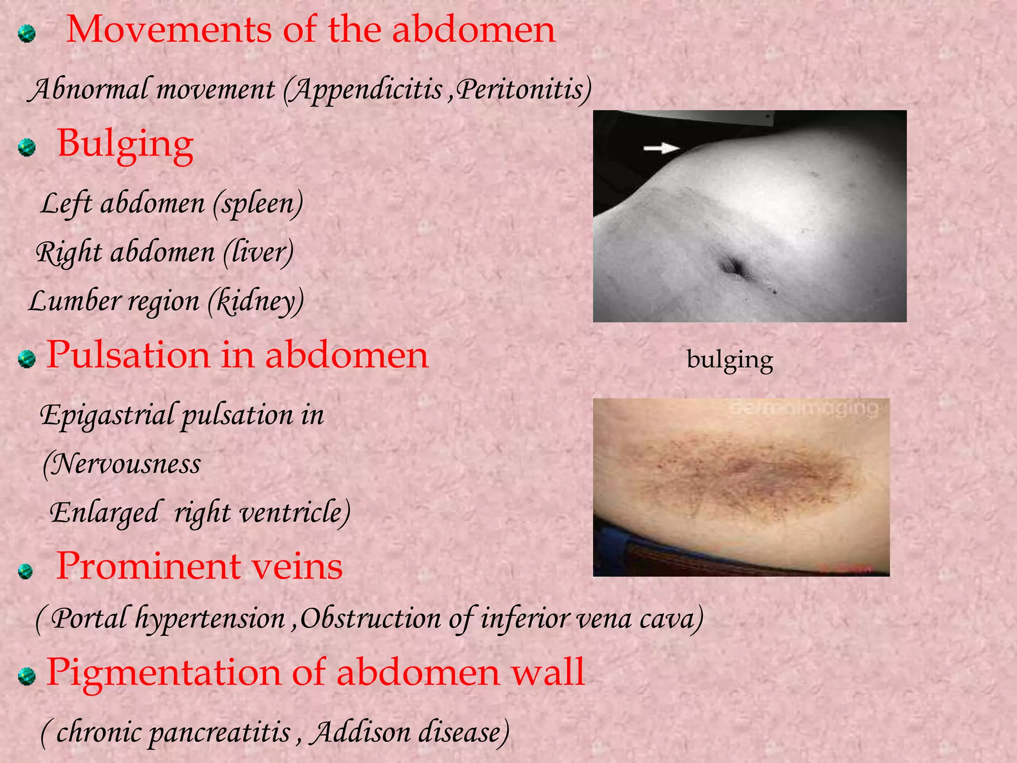 Movements of the abdomen
Abnormal movement (Appendicitis ,Peritonitis)
Bulging
Left abdomen (spleen)
Right abdomen (liver)
Lumber region (kidney)
Pulsation in abdomen bulging
Epigastrial pulsation in
(Nervousness
Enlarged right ventricle)
Prominent veins
( Portal hypertension ,Obstruction of inferior vena cava)
Pigmentation of abdomen wall
( chronic pancreatitis , Addison disease)
 