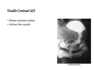 Double Contrast UGI
• Shows mucosal surface
• Utilizes the crystals
 