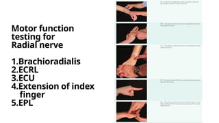 Examination of Hand as a plastic surgeon .pptx