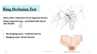 Examination of Hernia - Dr. Neha Palase.pptx
