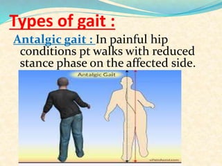 Examination of hip,final | PPTX