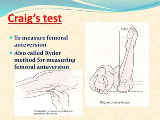 Examination of hip,final | PPTX