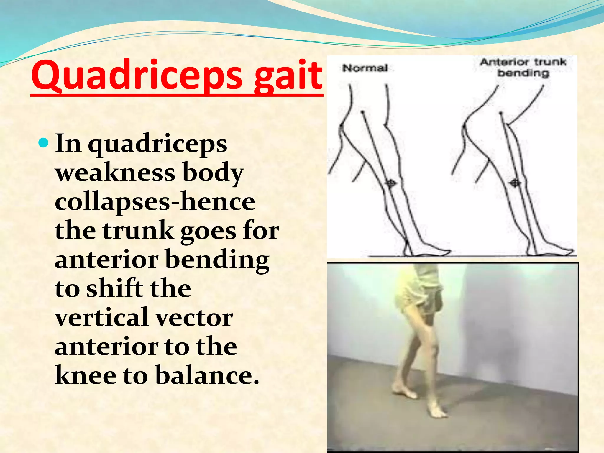 Quadriceps gait
 In quadriceps
weakness body
collapses-hence
the trunk goes for
anterior bending
to shift the
vertical vector
anterior to the
knee to balance.
 