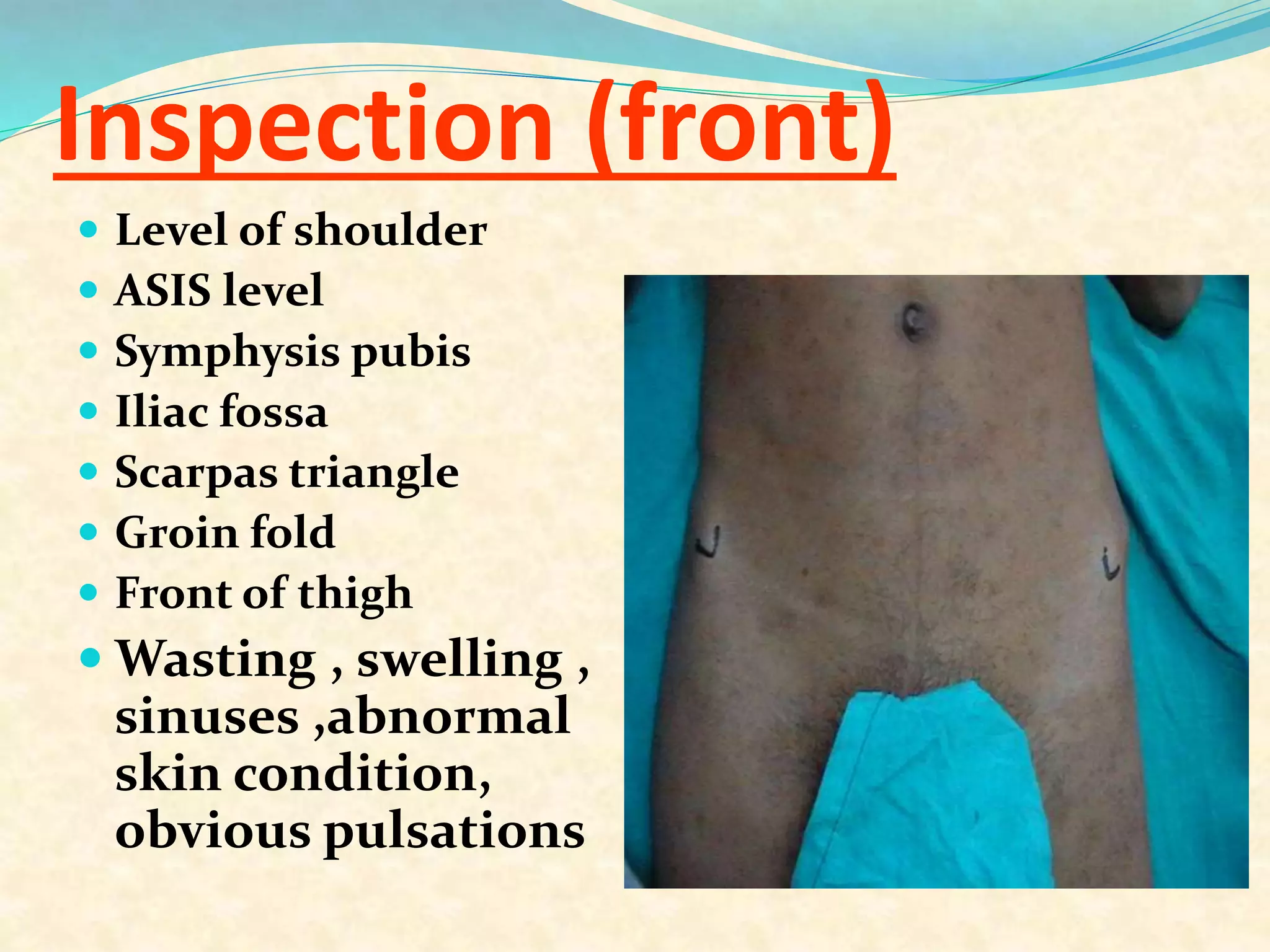 Inspection (front)
 Level of shoulder
 ASIS level
 Symphysis pubis
 Iliac fossa
 Scarpas triangle
 Groin fold
 Front of thigh
 Wasting , swelling ,
sinuses ,abnormal
skin condition,
obvious pulsations
 