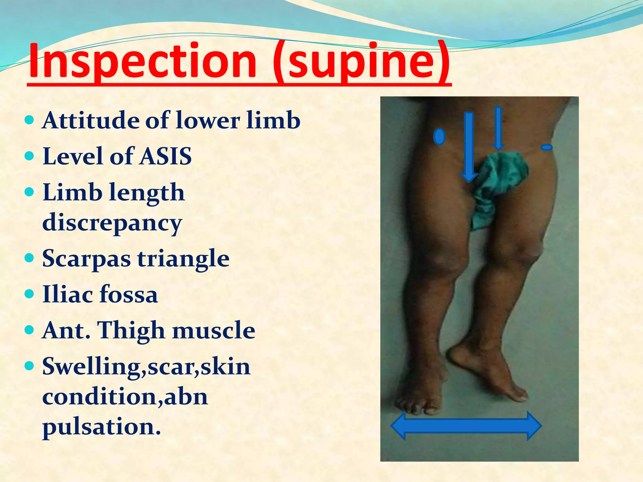 Inspection (supine)
 Attitude of lower limb
 Level of ASIS
 Limb length
discrepancy
 Scarpas triangle
 Iliac fossa
 Ant. Thigh muscle
 Swelling,scar,skin
condition,abn
pulsation.
 