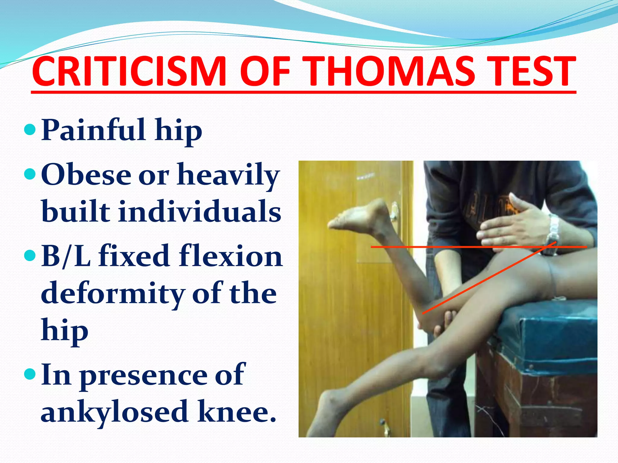CRITICISM OF THOMAS TEST
Painful hip
Obese or heavily
built individuals
B/L fixed flexion
deformity of the
hip
In presence of
ankylosed knee.
 