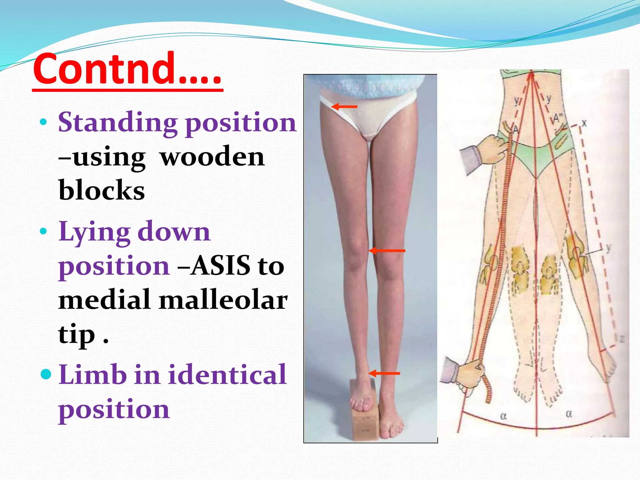 Contnd….
• Standing position
–using wooden
blocks
• Lying down
position –ASIS to
medial malleolar
tip .
 Limb in identical
position
 