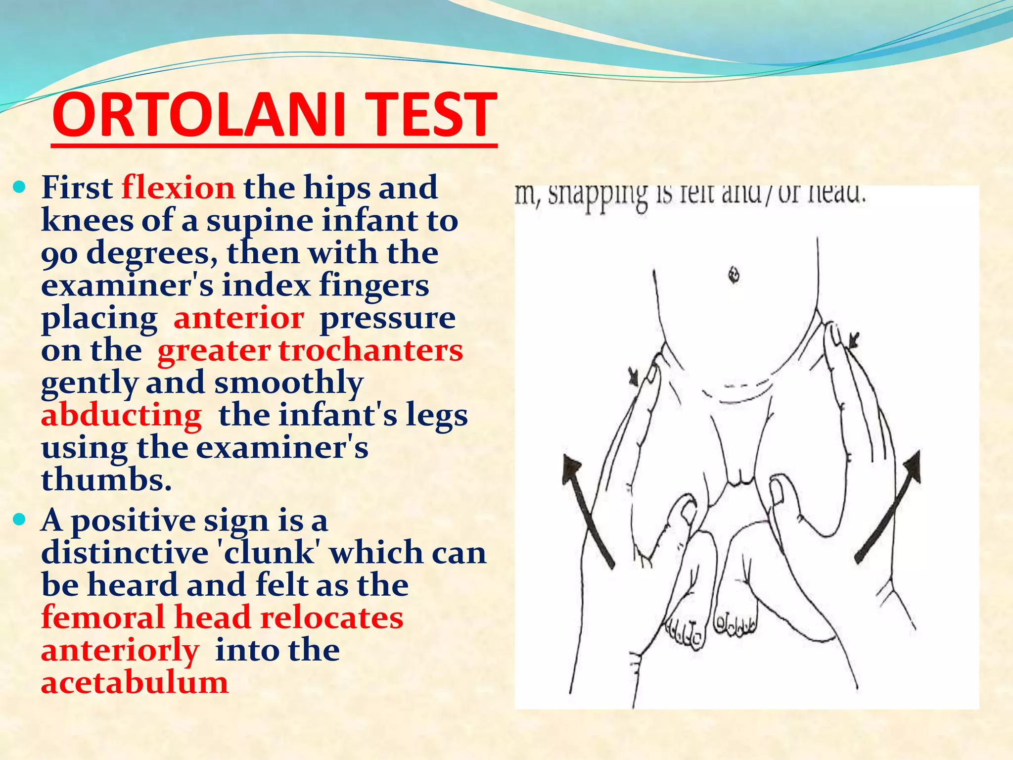 ORTOLANI TEST
 First flexion the hips and
knees of a supine infant to
90 degrees, then with the
examiner's index fingers
placing anterior pressure
on the greater trochanters
gently and smoothly
abducting the infant's legs
using the examiner's
thumbs.
 A positive sign is a
distinctive 'clunk' which can
be heard and felt as the
femoral head relocates
anteriorly into the
acetabulum
 