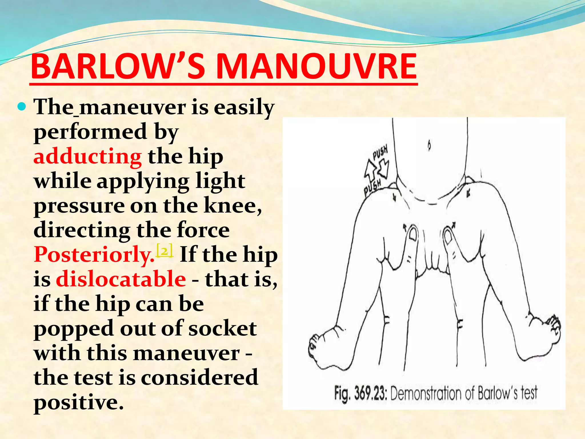 BARLOW’S MANOUVRE
 The maneuver is easily
performed by
adducting the hip
while applying light
pressure on the knee,
directing the force
Posteriorly.[2] If the hip
is dislocatable - that is,
if the hip can be
popped out of socket
with this maneuver -
the test is considered
positive.
 