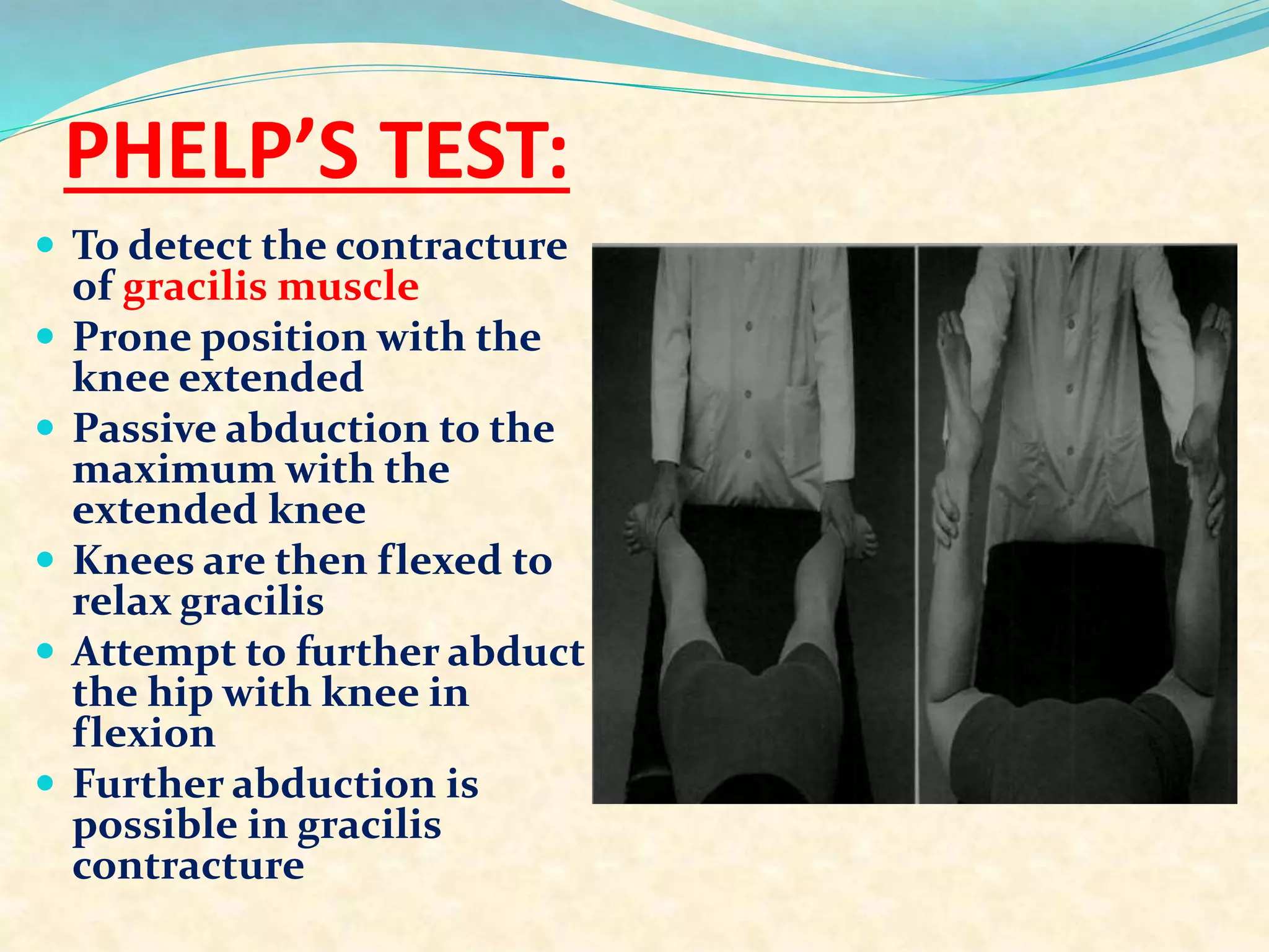 PHELP’S TEST:
 To detect the contracture
of gracilis muscle
 Prone position with the
knee extended
 Passive abduction to the
maximum with the
extended knee
 Knees are then flexed to
relax gracilis
 Attempt to further abduct
the hip with knee in
flexion
 Further abduction is
possible in gracilis
contracture
 