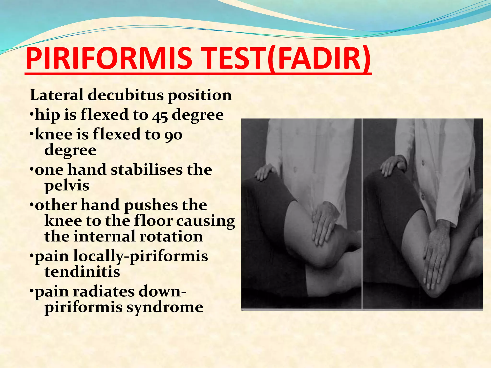 PIRIFORMIS TEST(FADIR)
Lateral decubitus position
•hip is flexed to 45 degree
•knee is flexed to 90
degree
•one hand stabilises the
pelvis
•other hand pushes the
knee to the floor causing
the internal rotation
•pain locally-piriformis
tendinitis
•pain radiates down-
piriformis syndrome
 