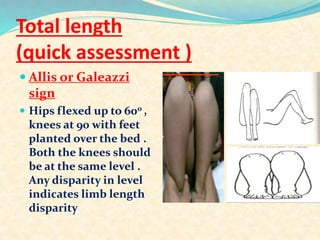 Examination of hip joint | PPTX
