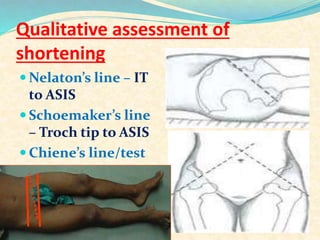 Examination of hip joint | PPTX